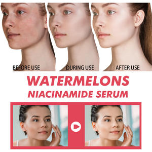 Niacinamide Watermelon Essence Hydrating Lightening Spot-Smoothing Firming and Brightening Skin Serum - Product Image 4