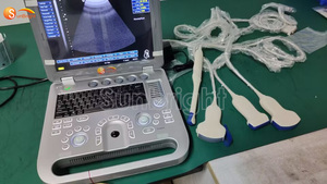 Ecografía Vascular, Cardíaca y Fetal, Ultrasonido 3D 4D, Rentable - Product Image 6