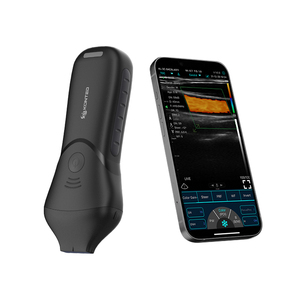 KONTED C10MB <span class=keywords><strong>Pro</strong></span> Conexión WIFI y USB Mini Ecógrafo Portátil de Mano de Alta Frecuencia - Product Image 4