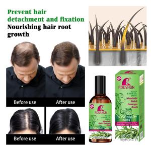Organik biberiye nane derisi ve tüm saç tipleri için saç güçlendirilmesi uçucu yağ özelleştirilebilir özel etiket - Product Image 2