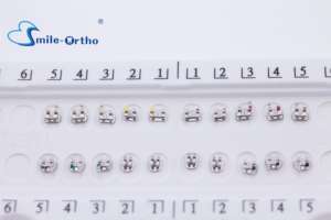 Paquet de carte d'attelle dentaire de vente chaude support en métal orthodontique Mini support Roth/MBT/Edgwwise 022/018 prix d'usine de fente - Product Image 5