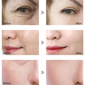 Sérum <span class=keywords><strong>Visage</strong></span> au Rétinol Marque Blanche <span class=keywords><strong>Anti</strong></span>-Âge Éclaircissant Hydratant Cosmétiques Produits de Soin Beauté Essence Faciale - Product Image 3