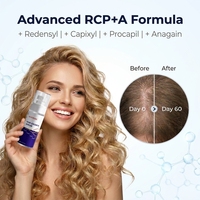 Spray Redensyl+Capixyl+Procapil+Anagain pour la croissance et l'épaississement des cheveux, combat la perte de cheveux et le traitement de la calvitie pour hommes et femmes