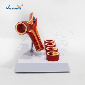Y-образная модель атеросклероза артерии раздельная модель тромба анатомические модели анатомических моделей сосудов кровеносных сосудов - Product Image 2