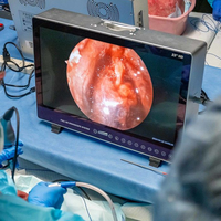 Système de caméra endoscopique portable HD IKEDA YKD-9122 avec source de lumière LED pour la chirurgie