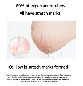 Crème <span class=keywords><strong>anti</strong></span>-vergetures dissolvant de cicatrices hydratant réparation de l'abdomen ventre <span class=keywords><strong>Anti</strong></span>-rides <span class=keywords><strong>grossesse</strong></span> soins de la peau - Product Image 5