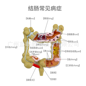 Modèle humain de petite maladie du côlon ; modèle de côlon en proctologie et gastroentérologie ; côlon en gastroentérologie ; intestin. - Product Image 1