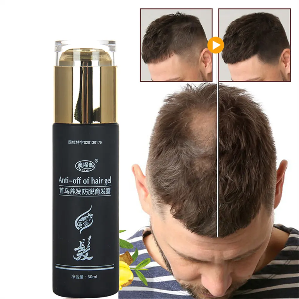 Haarpflege flüssiges Haar Haarlinienförderung Wachstum flüssiges Haar pflegendes Essenz Platycystis Blatt für Männer und Frauen