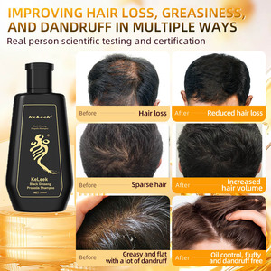Shampoo antipelliculaire KeLeek au ginseng noir et à <span class=keywords><strong>la</strong></span> <span class=keywords><strong>propolis</strong></span>, renforce les racines des cheveux, nettoyage en profondeur pour les cheveux gras, 260 ml - Product Image 5