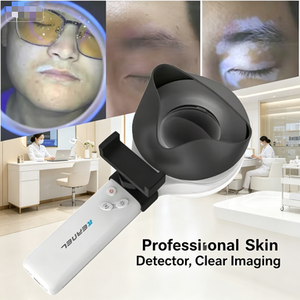 Detector de <span class=keywords><strong>Piel</strong></span> Portátil para Dermatología, Lámpara de Woods Kernel KN-9000B, Detecta Infecciones Bacterianas o Fúngicas <span class=keywords><strong>en</strong></span> el Cuero Cabelludo - Product Image 1