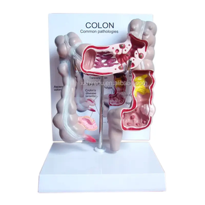 Modèle anatomique humain agrandi pour l'enseignement médical : système digestif, appendice et cæcum - Product Image 2