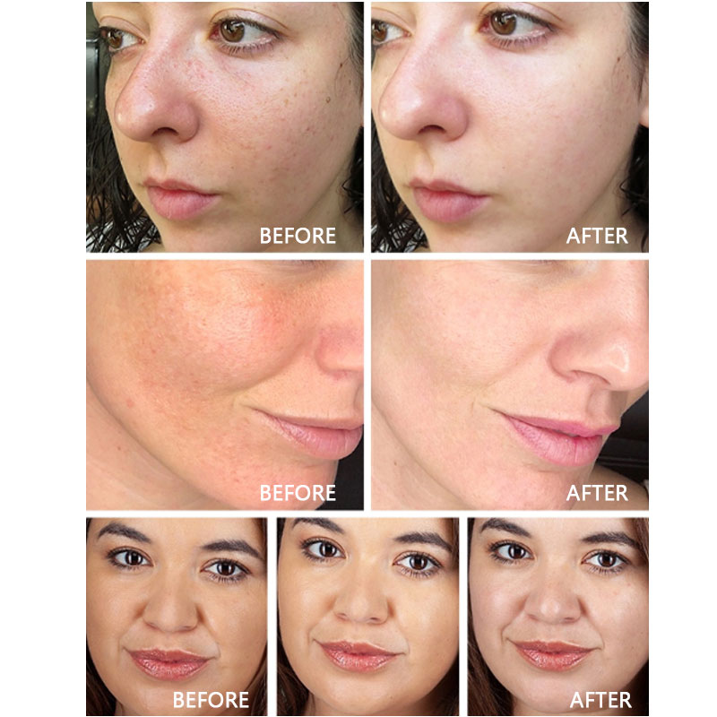 Hot Selling Skin Care Anti Aging Wrinkle Moisturizing Lightening Hydrating Hyaluronic Acid Face Cream