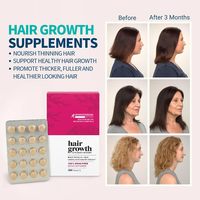 Complément alimentaire 100 % naturel sans médicament pour la croissance des cheveux, pour hommes et femmes, comprimés avancés pour la santé capillaire