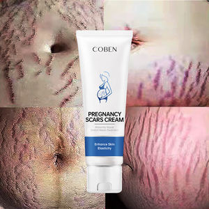 โลชั่นบํารุงผิวออร์แกนิกสําหรับกําจัดรอยแตกลาย ส่วนผสมที่ใช้กลีเซอรีน - Product Image 1