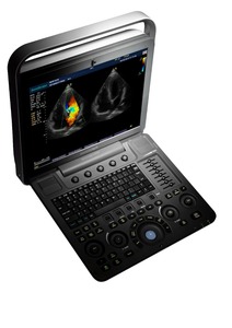 Équipement médical à ultrasons Sonoscape S9, appareil à ultrasons portable, échographe Doppler - Product Image 2