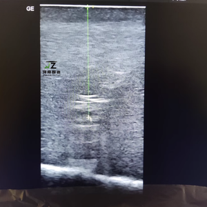 แบบจำลองการสอนการเจาะเนื้อเยื่อภายใต้การนำทางด้วยอัลตราซาวด์ (สีผิว) - Product Image 4