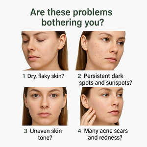 Jabón Aclarante 85g OEM Marca Privada con Extracto de Gayuba, Ácido Kójico y Regaliz para Desvanecer Manchas Oscuras, Vegano - Product Image 5