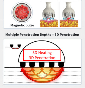 Máquina original de fábrica con forma de cuerpo, cuello y cuerpo, nueva tecnología revolucionaria - Product Image 4