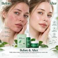 Usine chaude cosmétiques produits de soins de la peau Anti-âge thé vert blanchissant collagène visage sérum visage Essence crème ensemble de soins de la peau
