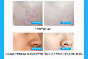 热纯小分子中胶原蛋白透明质酸精华交联<span class=keywords><strong>HA</strong></span>美白保湿透明质酸Y - Product Image 5