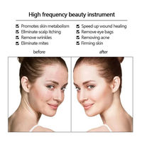 Masseur facial à haute fréquence à prix de gros, portable, avec lumières LED, appareil de soin de la peau à domicile pour lutter contre le vieillissement