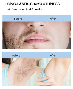 <span class=keywords><strong>Cera</strong></span> di pasta zuccherata morbida personalizzata dalla fabbrica di zuccheraggio per peli facciali, braccia, depilazione per il corpo - Product Image 4