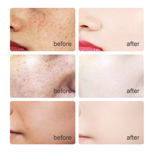 Glow Boosting Serum siero schiarente idratante sbiancante <span class=keywords><strong>viso</strong></span> glycyrhiza Glabra siero per macchie scure linee sottili pelle irregolare Ton - Product Image 2