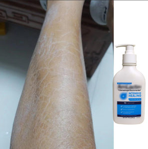 Lozione Corpo Extra Schiarente Biologica Idratante per <span class=keywords><strong>Pelle</strong></span> da <span class=keywords><strong>Secca</strong></span> a <span class=keywords><strong>Molto</strong></span> <span class=keywords><strong>Secca</strong></span> - Product Image 1