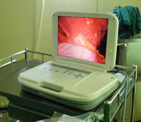 Chirurgie médicale d'urologie d'articulation de nez d'oreille caméra portative complète d'endoscope de Hd