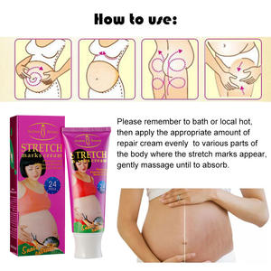 Aichun-crema elástica para eliminar cicatrices, crema <span class=keywords><strong>de</strong></span> marcas <span class=keywords><strong>de</strong></span> estiramiento para mujeres - Product Image 3