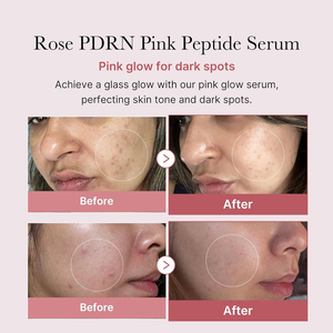 Atacado PDRN Pink Peptide Serum Pink Glow Niacinamida para Pele Hidratante & Hidratante & Refirmante Coreano Skincare Serum - Product Image 2