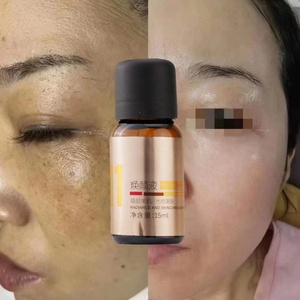 สารกำจัดฝ้าสำหรับผิวหน้าแบบมืออาชีพ, เซรั่มกำจัดคราบสารเคมี - Product Image 4