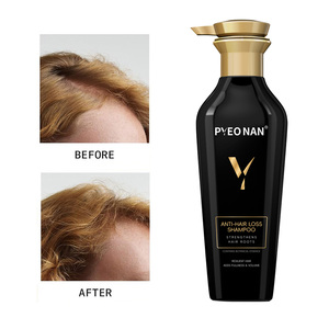 Shampooing Bio au Gingembre <span class=keywords><strong>Anti</strong></span>-<span class=keywords><strong>Chute</strong></span> et Favorisant la Croissance, Soin Épaississant du Cuir Chevelu, Repousse des Cheveux, Biotine, Marque Privée - Product Image 2