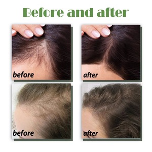 Loción en aerosol para tratamiento de nutrientes de raíz de cabello de etiqueta privada para uso diario, prevención y nutrición naturales de la pérdida de cabello - Product Image 6