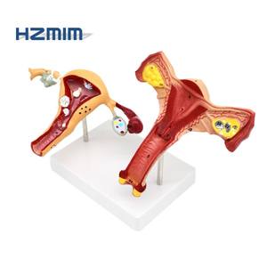 Модель обучения медицинской науке пластиковая модель влагалища матки - Product Image 2