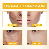 OEM/ODM Tónico Facial de Té Verde y Aloe Vera, Líquido Suave para el Cuidado Diario de la Piel, Deja la Piel Suave, Hidratada, Radiante y Refrescante