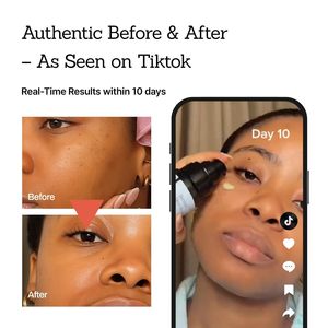 Suero Iluminador de Piel, Loción Facial Hidratante con Retinol y Niacinamida, Suero Facial Aclarante - Product Image 5