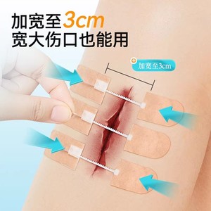 แถบยางยืดโคโฟเอ 19.5 ซม. X 4 ซม. สำหรับเด็ก วัสดุเย็บแผลแบบกาวทางการแพทย์สำหรับการจัดการรอยแผลเป็น - Product Image 3