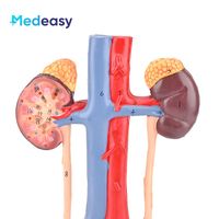 Modelo de Sistema Urinario estereoscópico 3D humano con modelo de anatomía de riñón de vena arterial
