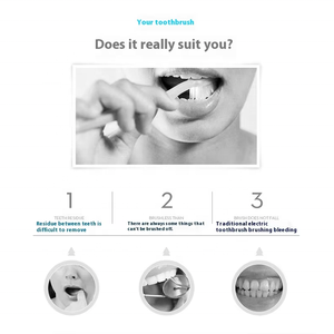 Cepillo de Dientes Eléctrico en Forma de U Generación II Limpiador Oral Sónico con Cerdas Suaves para Blanqueamiento de Bebés y Adultos - Product Image 3