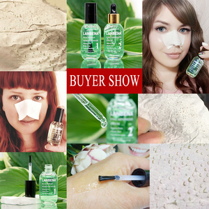 Kit de suppression des points noirs au thé vert <span class=keywords><strong>LANBENA</strong></span>, masque anti-points noirs, minimiseur de pores, sérum pour le visage - Product Image 5