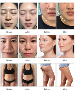 JF781B Promotion Price Salon 10 in 1 80k Quick Lipo Fat Loss Vacuum Body Slimming Cavit <b>Machine</b> 80k - Product Image 5