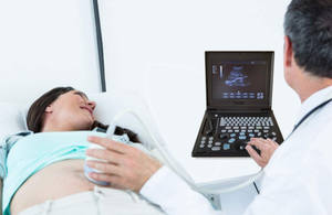 CHINCAN CK-2288Z 노트북 흑백 초음파 진단 시스템 초음파 스캐너 기계 프로브와 함께 - Product Image 4