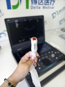 Sistema de Diagnóstico de Ecocardiografía Doppler a Color Portátil SonoScape E11 Propet, Precio del Ultrasonido Veterinario - Product Image 3