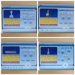 Appareil de <span class=keywords><strong>cavitation</strong></span> ultrasonique RF 9-en-1 pour le bureau, technologie de refroidissement au laser <span class=keywords><strong>lipo</strong></span> et photon pour le rajeunissement de la peau du visage et du corps entier - Product Image 6