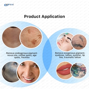 Vĩnh viễn hình xăm đốm loại bỏ <span class=keywords><strong>Q</strong></span> chuyển đổi di động 3 trong 1 Pico Máy 755nm Loại bỏ hình xăm Máy Nd Yag laser picolaser - Product Image 4