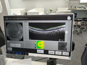 Retiview-500 gambar yang baik dan perangkat lunak analisis teknik pencitraan resolusi tinggi mesin tomografi orgasme optik Okt - Product Image 3