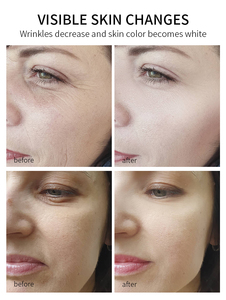 Máscara de clareamento facial, spa natural, anti-envelhecimento, hidratante, pétalas de rosa, máscara de gelatina em pó - Product Image 5