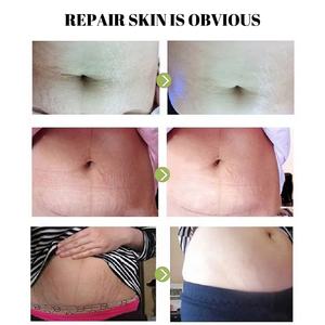 Nouvelle crème Anti-vergetures originale pour soins de la peau de <span class=keywords><strong>grossesse</strong></span> avec du beurre de karité, vitamine E, <span class=keywords><strong>huile</strong></span> d'argan, Centella - Product Image 6