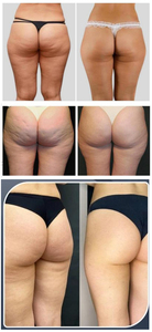 ราคาขายส่ง เครื่องนวดสลายเซลลูไลท์ รุ่นใหม่ล่าสุด หมุนได้ 360 องศา ผ่อนคลายกล้ามเนื้อ เครื่องสั่นสะเทือน G9 - Product Image 6